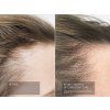 CSynouvelle Cosmeceuticals Pepti Hair X 06 (1)