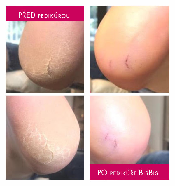 bisbis_pred_po_pedikura_02