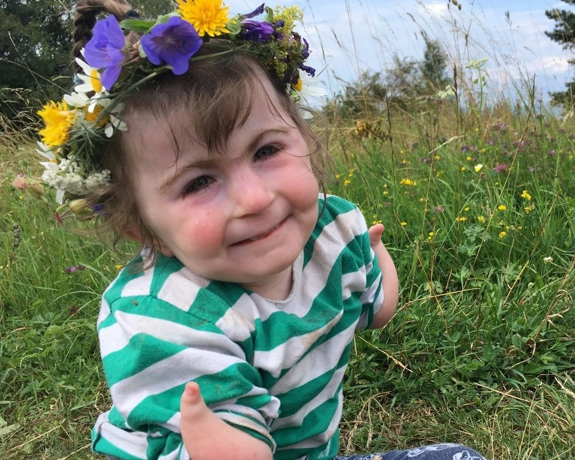 Co je Cornelia de Lange syndrom a jak ho léčit