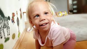 Co je Smith-Magenisův syndrom u dětí a jak ho léčit