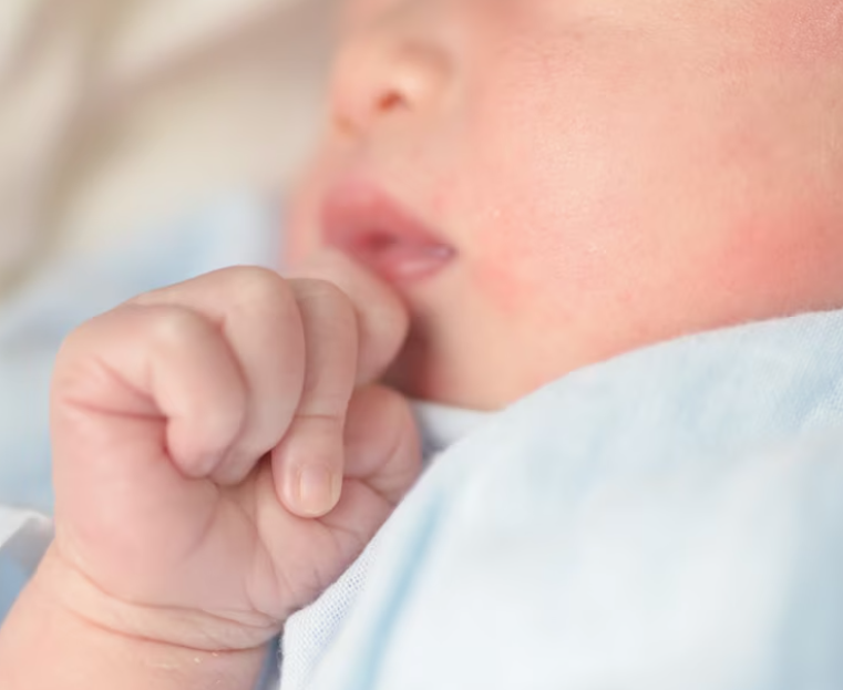 Seborea u miminka: Příčiny a léčba