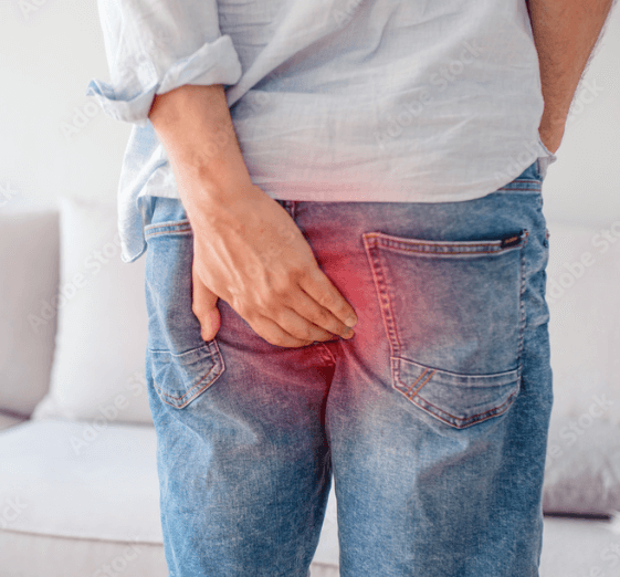 Jak se léčí hemeroidy a jak jim předcházet