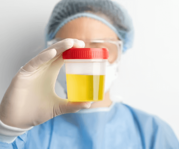 Krev v moči: Příčiny a léčba