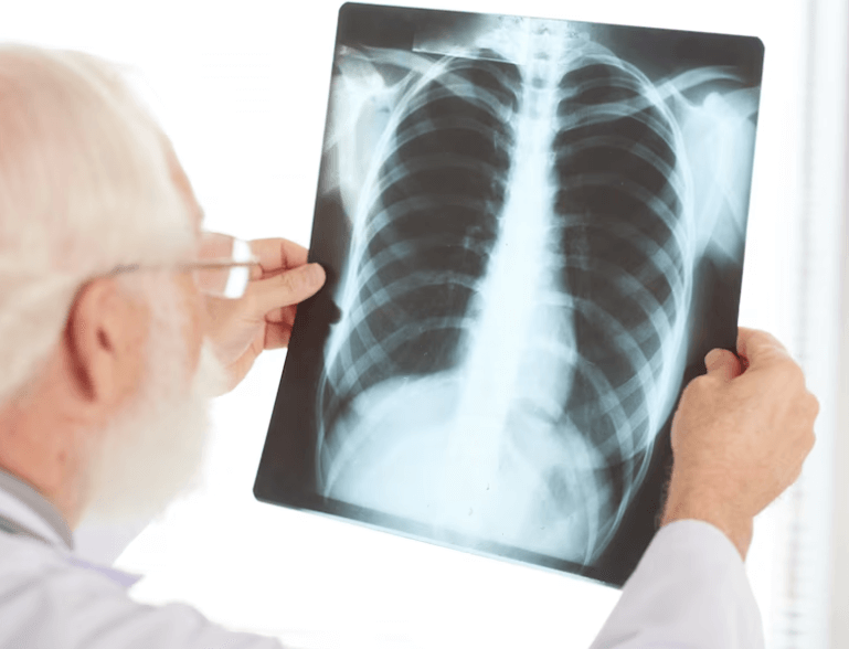 Jak rozpoznat zápal plic