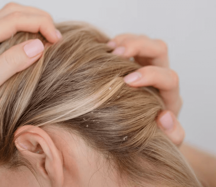 Jak se efektivně zbavit blech