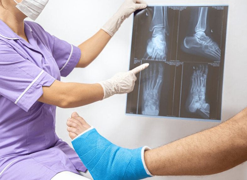 Jak dlouho srůstá zlomenina: Proces hojení a faktory