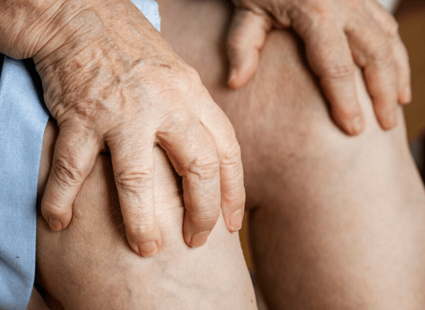 Co je artróza: Degenerativní onemocnění kloubů