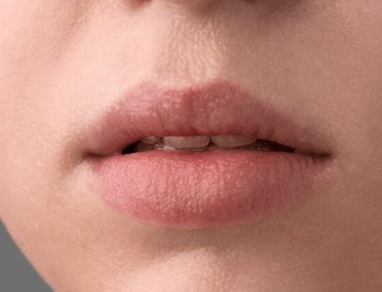 Jak léčit opar na rtech: Rady pro účinnou léčbu a prevenci