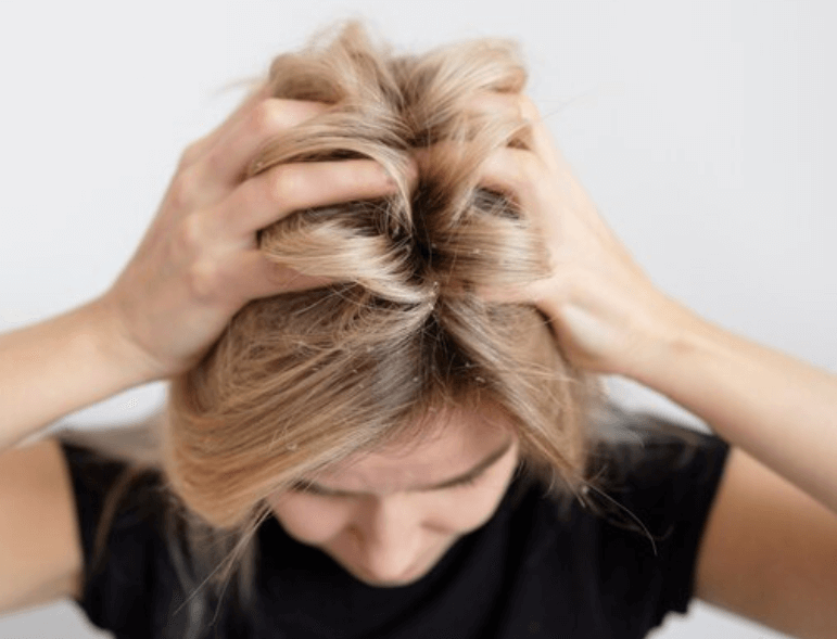 Jak vyzrát na mastné vlasy v 10 krocích?