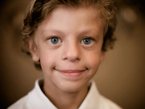 Co je Williamsův syndrom a jak se léčí