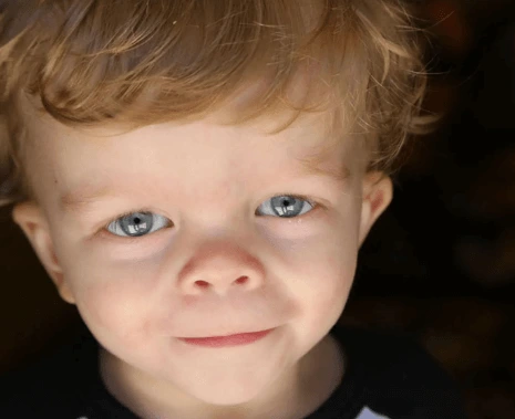 Co je Noonanův syndrom a jak se léčí