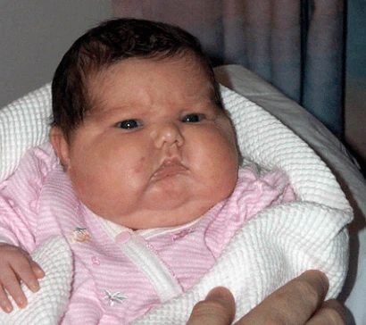 Co je Cushingův syndrom a jak se léčí