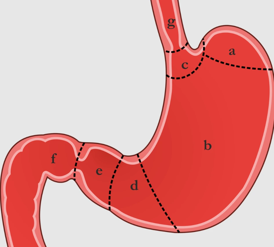 Co je Pylorostenóza a jak se léčí