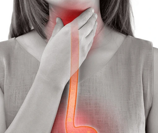 Co je Gastroezofageální reflux (GERD) a jak se léčí