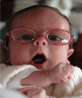 Co je Zellwegerův syndrom u dětí a jak se léčí