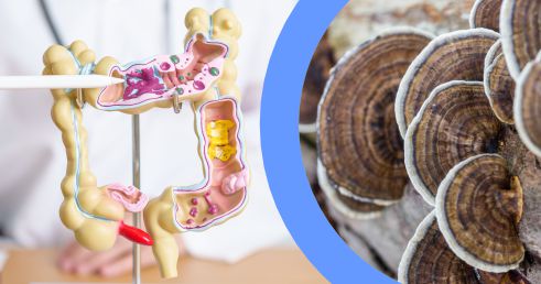 CORIOLUS - objavte tajomstvo ZDRAVIA ČRIEV