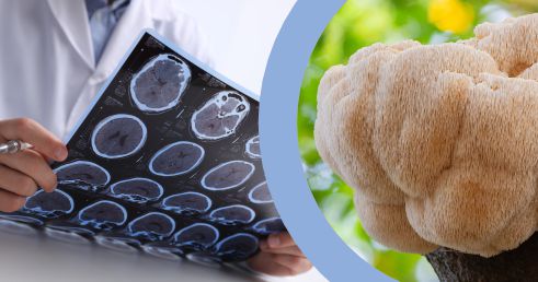 Potenciál huby Hericium pri liečbe sklerózy multiplex