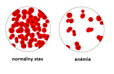 Léčba anémie