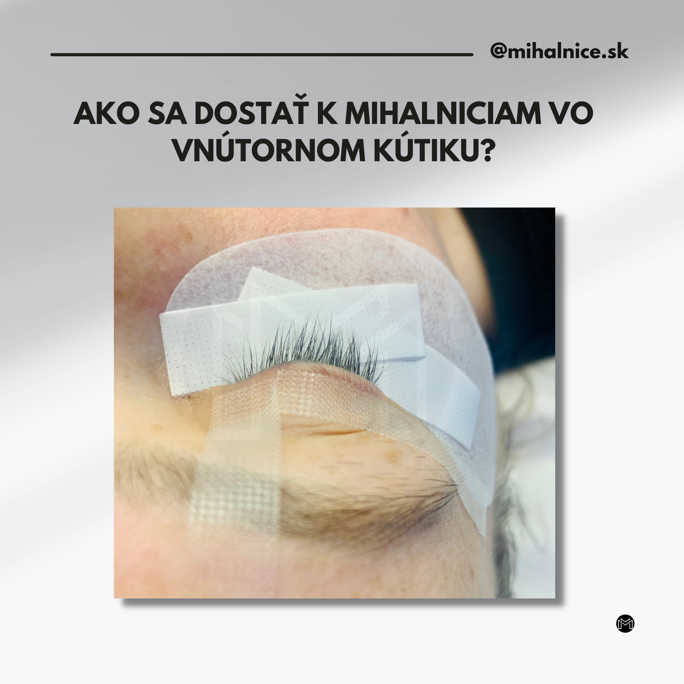 blog-ako-sa-dostat-k-mihalniciam-vo-vnutornom-kutiku