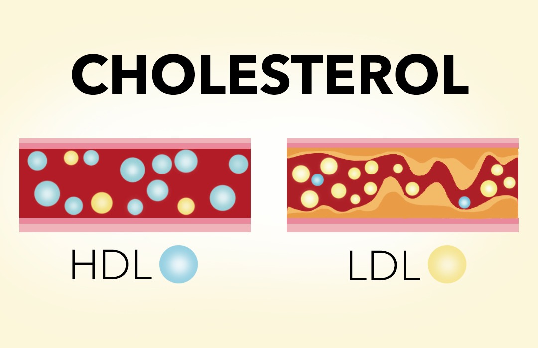 Typy cholesterolu