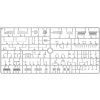 35416 sd kfz 234 2 with luchs turret interior kit miniart 07