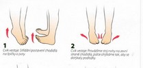 Poradíme Vám jak na problémy s plochou nohou