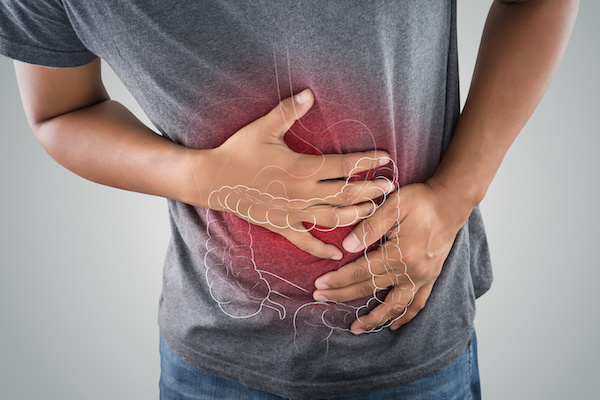 Colitis és CBD