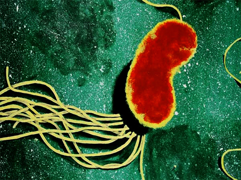 Pseudomonas-fluorescens