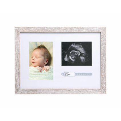 PEARHEAD Fotorámeček na foto z ultrazvuku přírodní