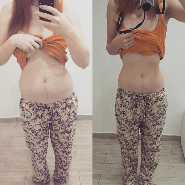 gabi_tremlova_pred_a_po