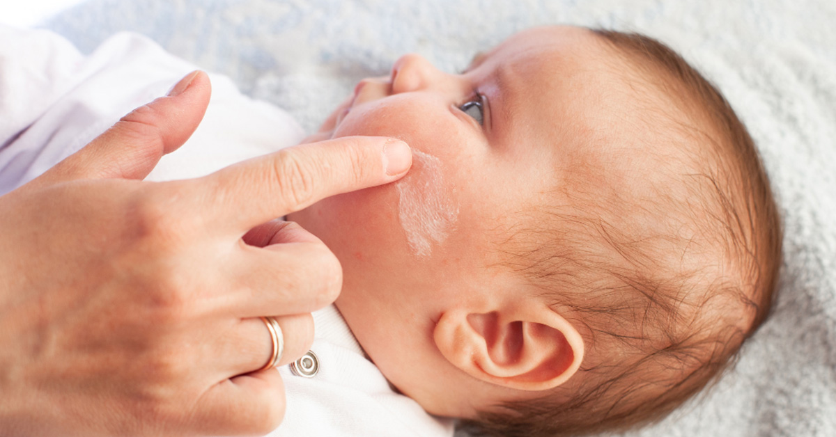 10 rad, jak zmírnit atopický ekzém u miminka