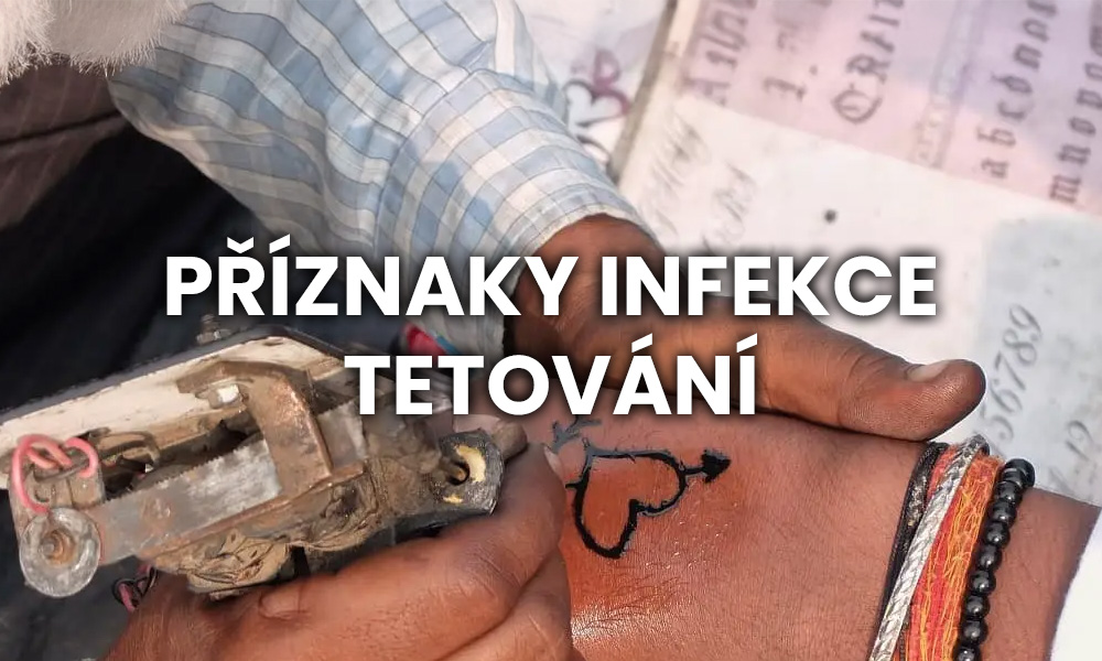 Příznaky infekce tetování
