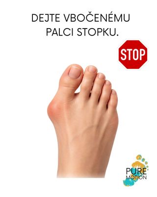✋ Dejte stopku vbočenému palci. 🪄 Kouzelný proutek nemáme. 👉 Ale vbočený palec často dokážeme rozhýbat, ulevit od bolesti...