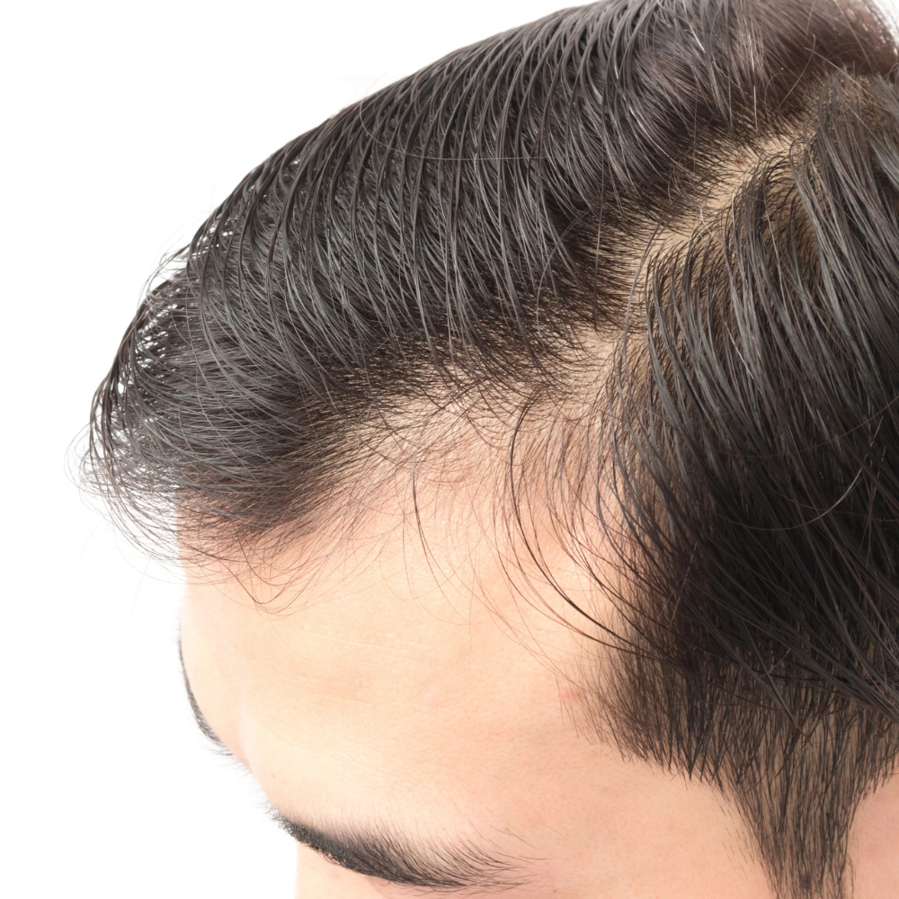 Recupera la densidad y vitalidad de tu cabello con Follixin