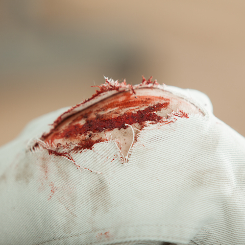 Řezné rány a anální fisury