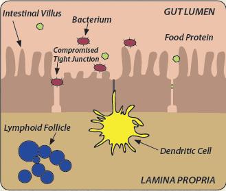 Gut lumen – střevní mikroflóra