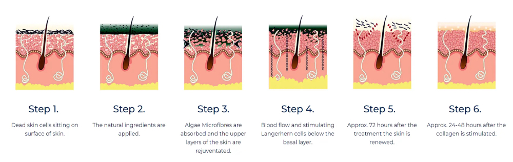 Decaar-algae-peeling