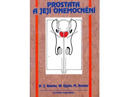 Prostata a její onemocnění - Prevence, léčba a operace, poruchy potence, Hans Joachim Reuter, 1989