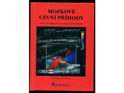 Cévní mozkové příhody, Jiří Polívka, 1998