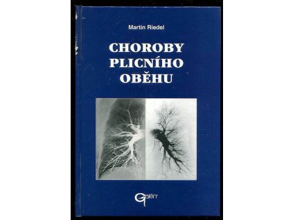 179859 choroby plicniho obehu
