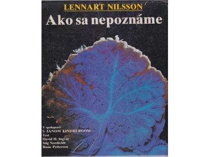 Ako sa nepoznáme : Objavná cesta s fotografickým aparátom do nášho tela, Lennart Nilsson, 1989