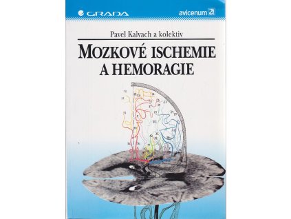 Mozkové ischemie a hemoragie, Pavel Kalvach, 1997
