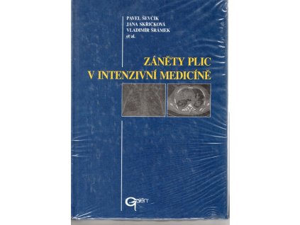Záněty plic v intenzivní medicíně