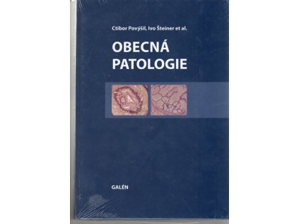 Obecná patologie, Ctibor Povýšil, 2011