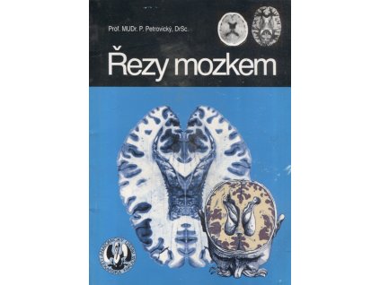 Řezy mozkem : Neuroanatomie, CT, NMR, P. Petrovický, 1993