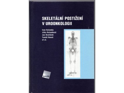 Skeletální postižení v uroonkologii, Ivan Kolombo, 2005