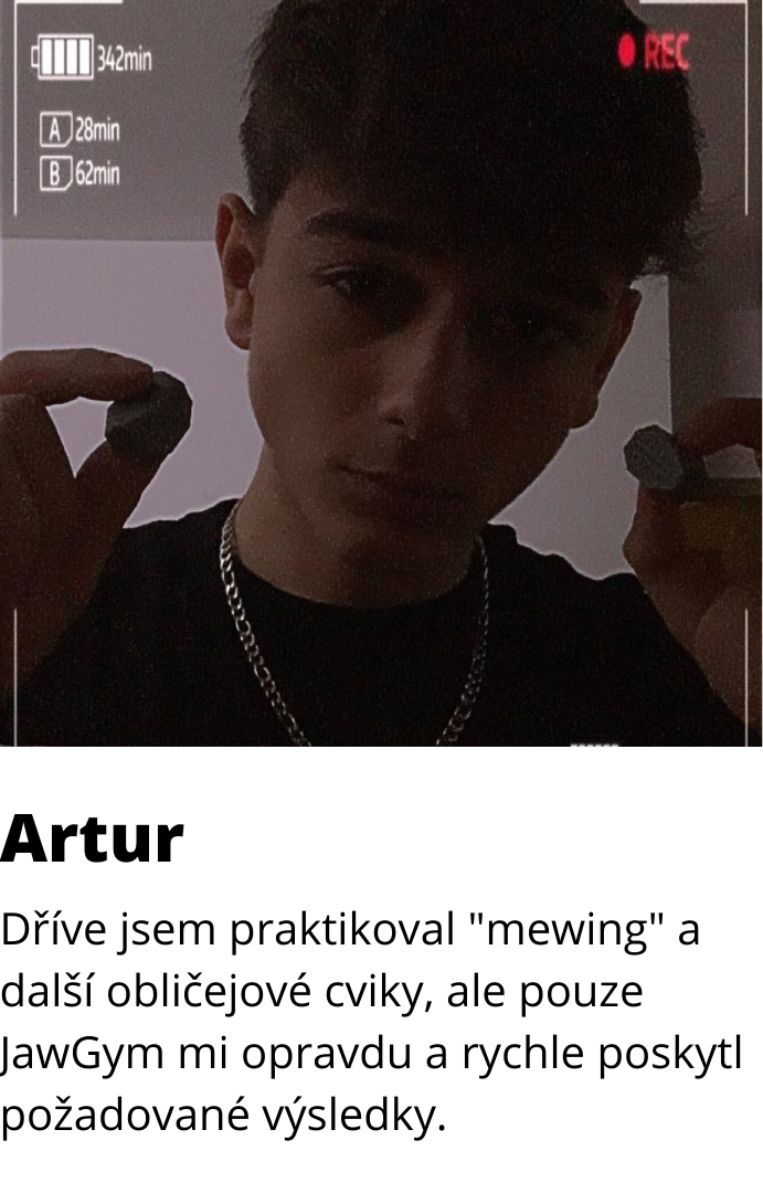 jawline výsledky