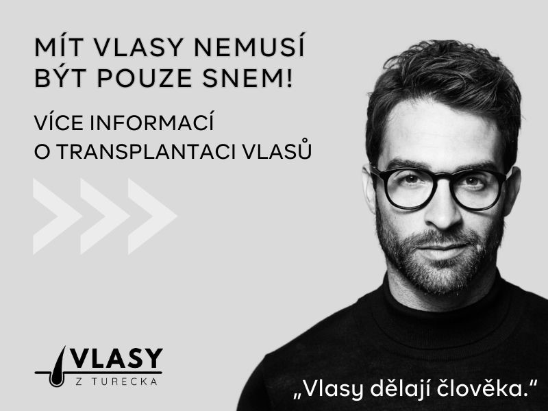 1. Transplantace vlasů v Turecku