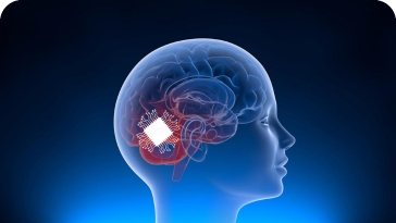 Elon Musk saját emlékeit rögzítette a Neuralinkben