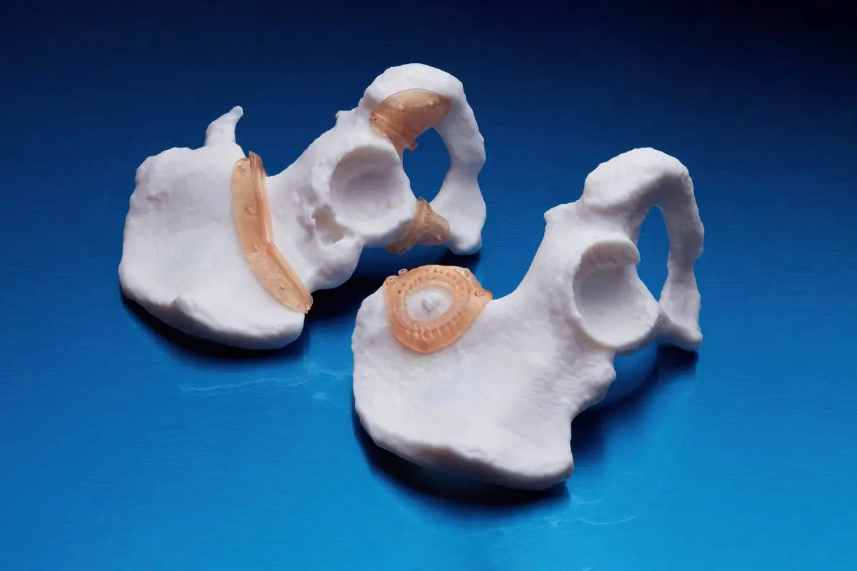 Formlabs_amber_metal_698_sh-standard_a_1